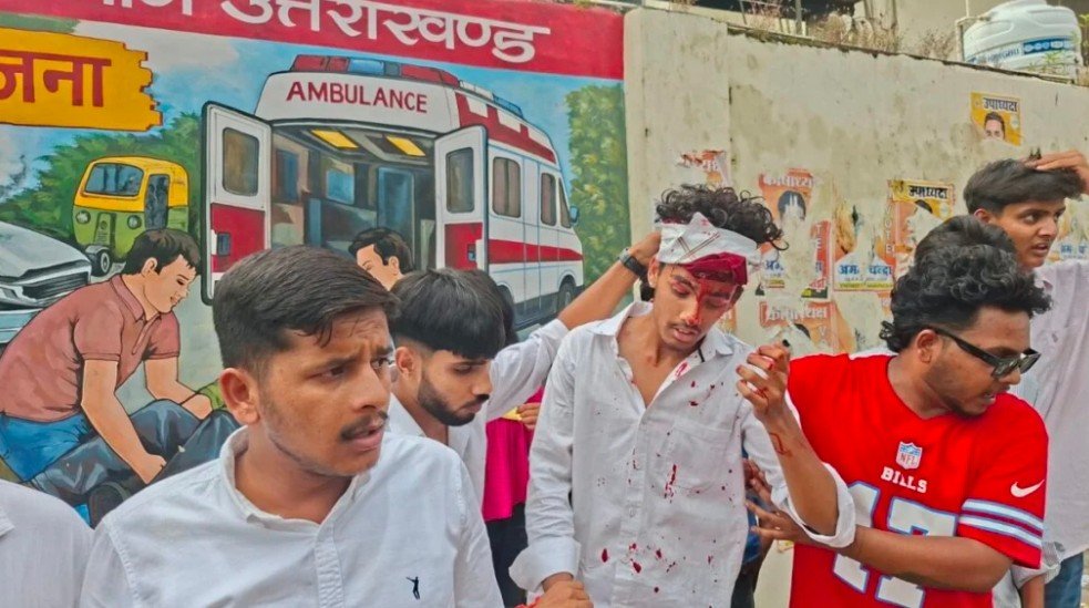 हल्द्वानी के एमबीपीजी कॉलेज में छात्रसंघ चुनाव में नैनीताल रोड पर छात्र छात्राओं गुट आपस में भिड़ गए एक घायल
